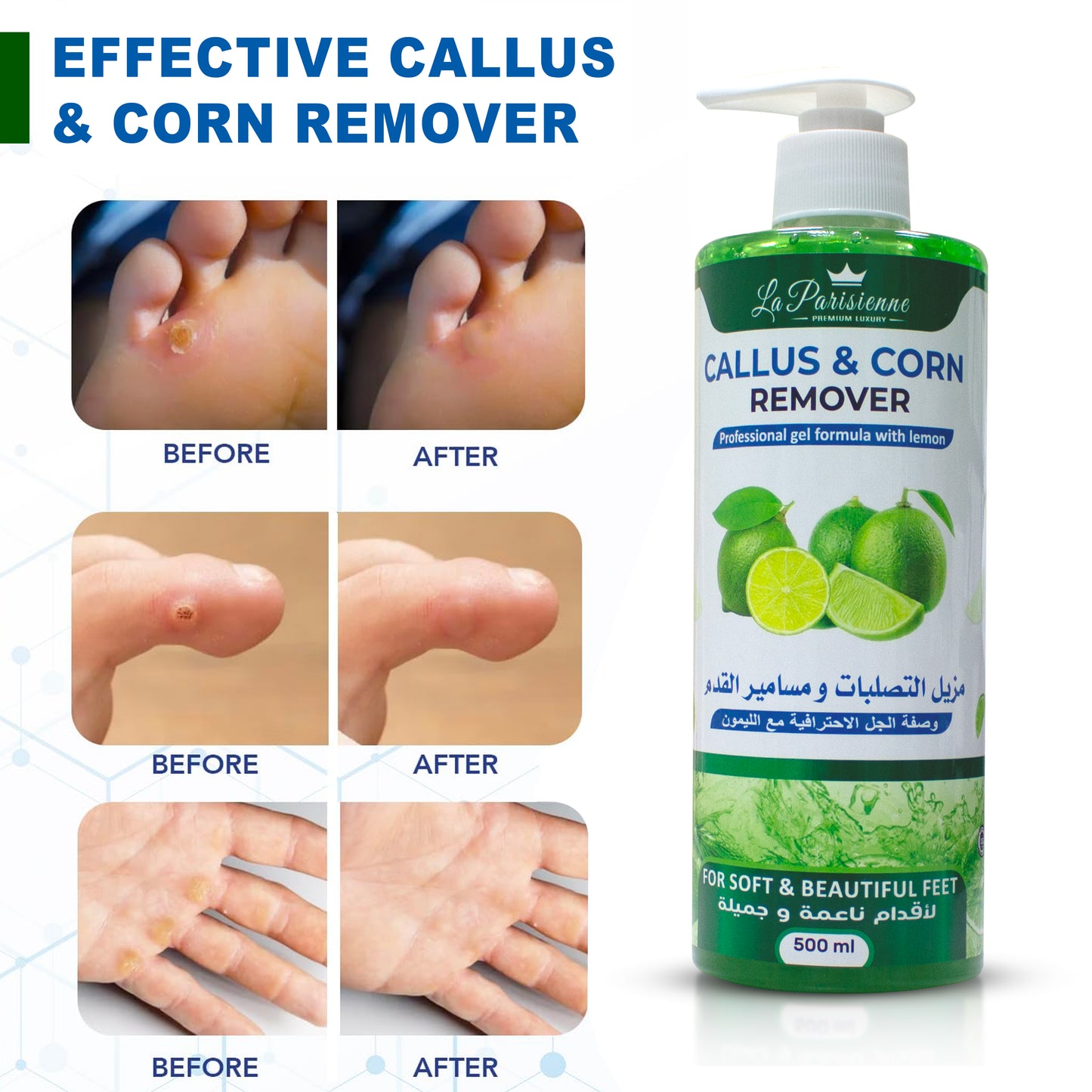 Callus & Corn Remover
